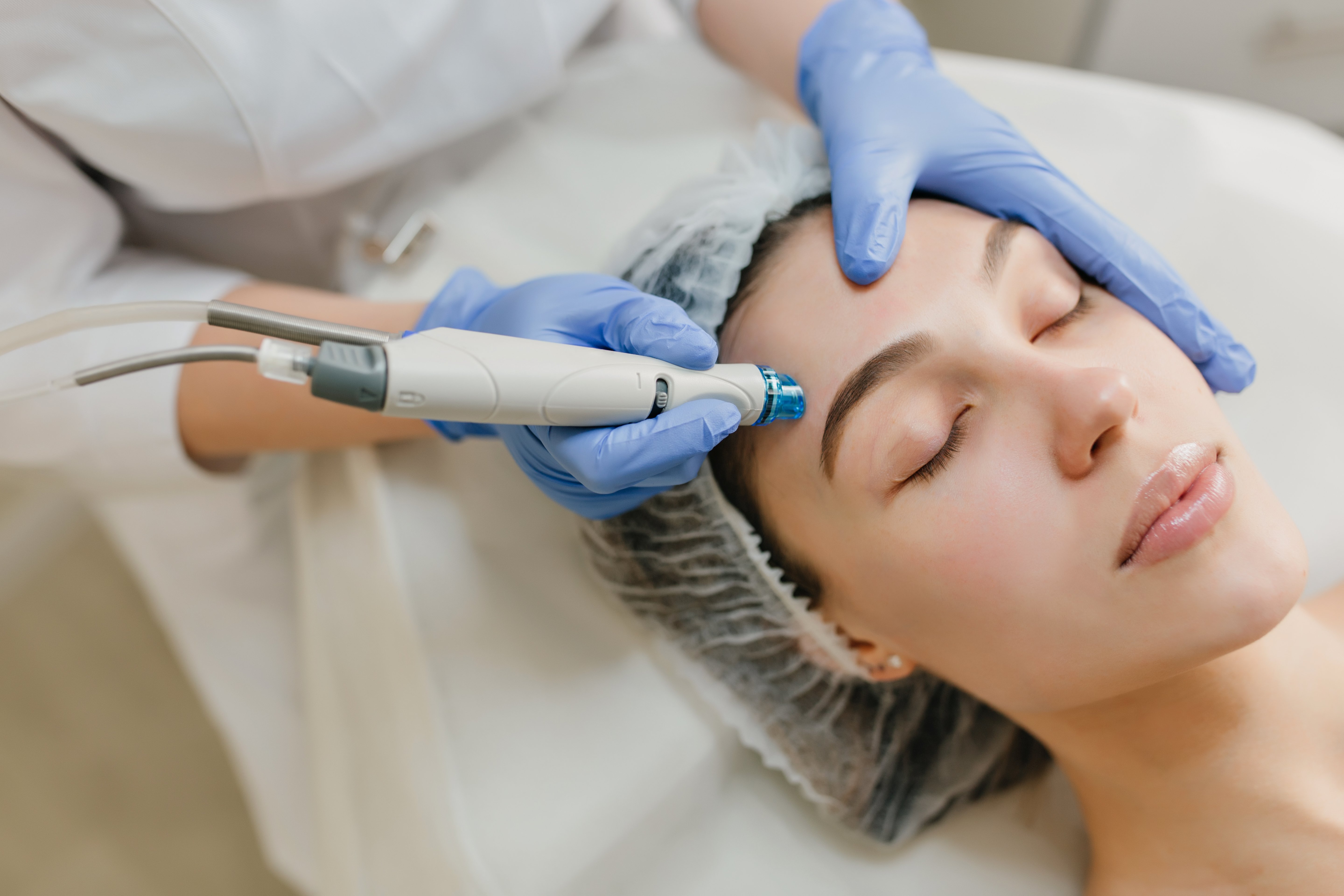 Hidrafacial (Hidrodermoabrasión)